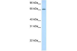 Human Thymus; WB Suggested Anti-ADAT1 Antibody Titration: 0. (ADAT1 antibody  (C-Term))