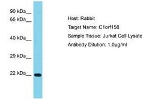 Image no. 1 for anti-Chromosome 1 Open Reading Frame 158 (C1ORF158) (AA 25-74) antibody (ABIN6750736)