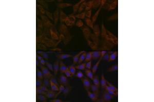 Immunofluorescence analysis of NIH-3T3 cells using  Rabbit mAb (ABIN7265484) at dilution of 1:100 (40x lens). (ARF5 antibody)