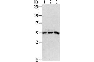 Gel: 6 % SDS-PAGE,Lysate: 40 μg,Lane 1-3: 293T cells, HepG2 cells, K562 cells,Primary antibody: ABIN7192647(SRP68 Antibody) at dilution 1/200 dilution,Secondary antibody: Goat anti rabbit IgG at 1/8000 dilution,Exposure time: 5 seconds (SRP68 antibody)