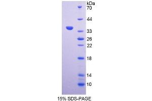 SDS-PAGE analysis of Rat AGGF1 Protein. (AGGF1 Protein)