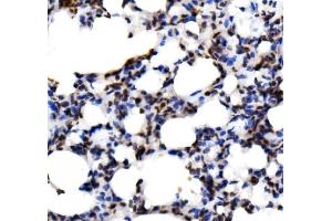 IHC analysis of KLF15 using anti-KLF15 antibody (ABIN7599269). (KLF15 antibody  (AA 1-323))