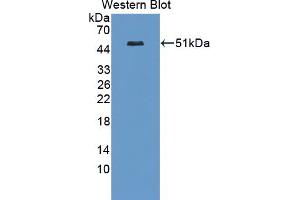 Figure. (Casein Kinase 1 delta antibody  (AA 1-409))