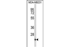 Western blot analysis of DERL2 Antibody in MDA-MB231 cell line lysates (35ug/lane) (Der1-Like Domain Family, Member 2 (DERL2) (AA 191-218), (C-Term) antibody)