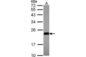 AP31081PU-N CAV2 antibody staining of A549 (A) whole cell lysate (30 µg) at 1/1000 dilution, 12% SDS PAGE.