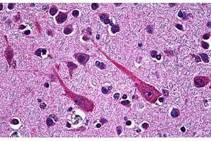 Human Brain, Cortex: Formalin-Fixed, Paraffin-Embedded (FFPE) (PCSK1 antibody  (AA 652-754))