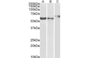 ABIN334455 (1µg/ml) staining of Human Kidney (A), Human Liver (B) and Rat Kidney (C) lysate (35µg protein in RIPA buffer). (P2RX4 antibody  (C-Term))