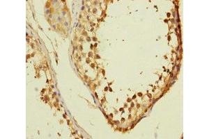 Immunohistochemistry of paraffin-embedded human testis tissue using ABIN7175312 at dilution of 1:100 (VPS33B antibody  (AA 348-617))