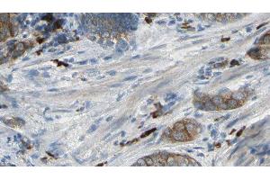 ABIN6277046 at 1/100 staining Human prostate tissue by IHC-P. (CAPZA2 antibody  (Internal Region))
