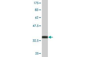 Western Blot detection against Immunogen (36. (BLMH antibody  (AA 356-454))