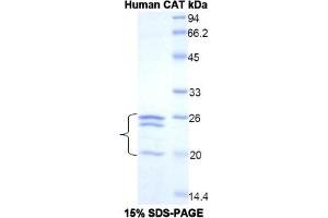 SDS-PAGE of Protein Standard from the Kit  (Highly purified E. (Catalase ELISA Kit)