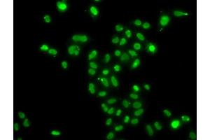Immunofluorescence analysis of  cells using MORF4L2 antibody (ABIN6128240, ABIN6143950, ABIN6143951 and ABIN6223485). (MORF4L2 antibody  (AA 1-100))