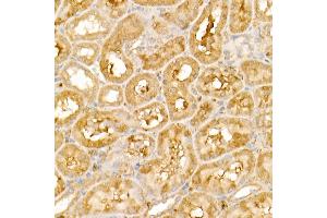 Immunohistochemistry of paraffin-embedded rat kidney using TRIM21/SS-A Rabbit pAb (ABIN6131376, ABIN6149506, ABIN6149507 and ABIN6217587) at dilution of 1:50 (40x lens). (TRIM21 antibody  (AA 80-330))
