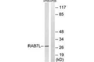 Western blot analysis of extracts from HT-29 cells, using RAB7L1 Antibody. (RAB7L1 antibody  (AA 115-164))