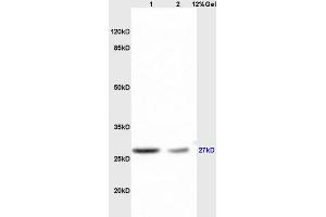 Lane 1: mouse brain lysates Lane 2: mouse liver lysates probed with Anti RPS6Polyclonal Antibody, Unconjugated (ABIN700885) at 1:200 in 4 °C. (RPS6 antibody  (AA 151-249))