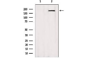 Western blot analysis of extracts from Rat heart, using MYH7-specific Antibody. (MYH7 antibody  (C-Term))