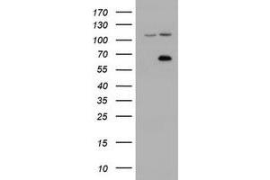Image no. 3 for anti-Zinc Finger, Imprinted 2 (ZIM2) (AA 1-150), (AA 428-527) antibody (ABIN1490591) (ZIM2 antibody  (AA 1-150, AA 428-527))