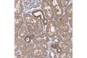 Immunohistochemical staining of human kidney with EFR3A polyclonal antibody  shows cytoplasmic positivity in tubular cells at 1:50-1:200 dilution.