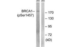Western blot analysis of extracts from 293 cells treated with epo 20U/ml 15', using BRCA1 (Phospho-Ser1457) Antibody.