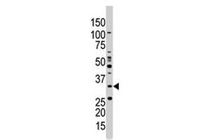 The PRKAB1 polyclonal antibody  is used in Western blot to detect PRKAB1 in Jurkat cell lysate . (PRKAB1 antibody  (N-Term))