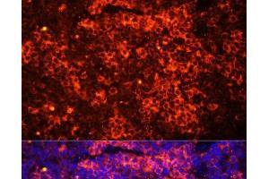 Immunofluorescence analysis of Mouse spleen using TLR8 Polyclonal Antibody at dilution of 1:100 (40x lens). (TLR8 antibody)