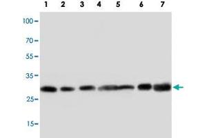 Western blot analysis of tissue and whole cell extracts with GJB1 polyclonal antibody . (GJB1 antibody  (Internal Region))