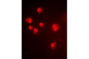 Immunofluorescent analysis of ALG-2 staining in Hela cells. (ALG2 antibody)