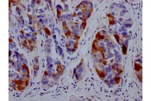 Immunohistochemistry (IHC) image for anti-Dihydrofolate Reductase (DHFR) antibody (ABIN7127454)