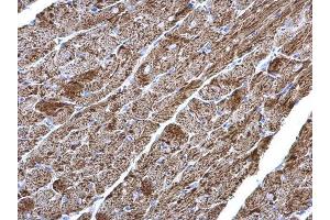 IHC-P Image NDUFV2 antibody detects NDUFV2 protein at mitochondria on mouse heart by immunohistochemical analysis. (NDUFV2 antibody  (Center))