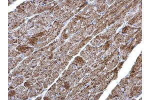 IHC-P Image NDUFV2 antibody detects NDUFV2 protein at mitochondria on mouse heart by immunohistochemical analysis.