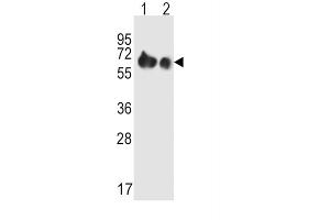 Western Blotting (WB) image for anti-Solute Carrier Family 3 (Activators of Dibasic and Neutral Amino Acid Transport), Member 2 (SLC3A2) antibody (ABIN2995541) (SLC3A2 antibody)