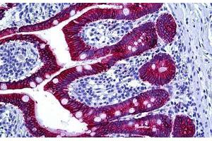 Human Intestine: Formalin-Fixed, Paraffin-Embedded (FFPE) (Keratin Basic antibody)