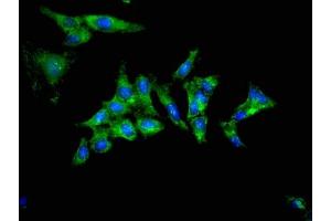Immunofluorescent analysis of Hela cells using ABIN7173361 at dilution of 1:100 and Alexa Fluor 488-congugated AffiniPure Goat Anti-Rabbit IgG(H+L) (TRIB2 antibody  (AA 204-337))