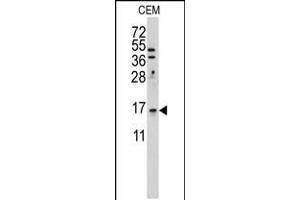 Western blot analysis of anti-LSM1 Antibody in Hela cell line lysates (35ug/lane) (LSM1 antibody  (C-Term))