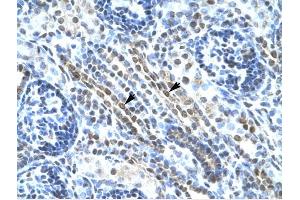 ANKRD11 antibody was used for immunohistochemistry at a concentration of 4-8 ug/ml to stain Epithelial cells of renal tubule (arrows) in Human Kidney. (ANKRD11 antibody  (N-Term))