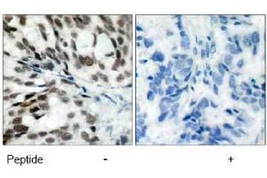 Image no. 1 for anti-Retinoblastoma 1 (RB1) (Ser780) antibody (ABIN197284) (Retinoblastoma 1 antibody  (Ser780))