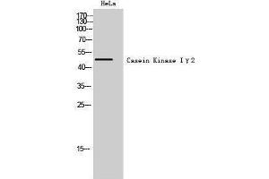 Western Blotting (WB) image for anti-Casein Kinase 1, gamma 2 (CSNK1G2) (N-Term) antibody (ABIN3174177) (Casein Kinase 1 gamma 2 antibody  (N-Term))