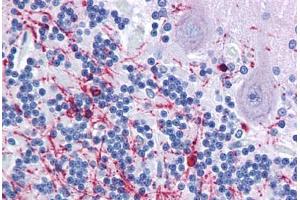 Human Brain, cerebellum: Formalin-Fixed, Paraffin-Embedded (FFPE) (Cnpase antibody  (AA 122-352))