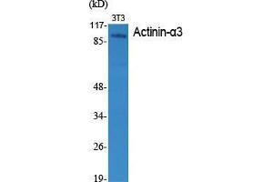 Western Blot (WB) analysis of specific cells using Actinin-alpha3 Polyclonal Antibody. (ACTN3 antibody  (N-Term))