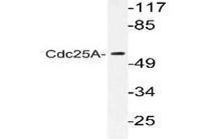 Image no. 1 for anti-Cell Division Cycle 25 Homolog A (S. Pombe) (CDC25A) antibody (ABIN271878) (CDC25A antibody)