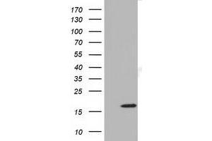 HEK293T cells were transfected with the pCMV6-ENTRY control (Left lane) or pCMV6-ENTRY TMEM80 (Right lane) cDNA for 48 hrs and lysed. (TMEM80 antibody)