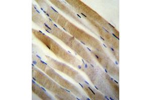 PRK (Thr172) antibody (Center) (ABIN654800 and ABIN2844475) immunohistochemistry analysis in formalin fixed and paraffin embedded human skeletal muscle followed by peroxidase conjugation of the secondary antibody and DAB staining. (PRKAA2 antibody  (Thr172))