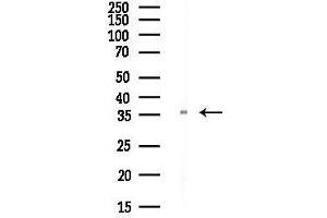 anti-Steroid Receptor RNA Activator 1 (SRA1) antibody