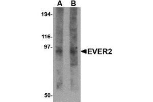Image no. 1 for anti-Transmembrane Channel-Like 8 (TMC8) (N-Term) antibody (ABIN1494395) (TMC8 antibody  (N-Term))
