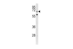 Western blot analysis of GARP antibody (Center) (ABIN390588 and ABIN2840908) in CEM cell line lysates (35 μg/lane). (LRRC32 antibody  (AA 234-260))