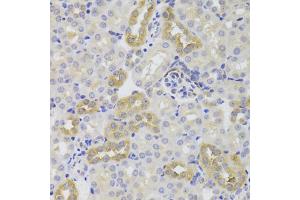 Immunohistochemistry of paraffin-embedded mouse kidney using TSC22D3 Antibody (ABIN5974107) at dilution of 1/100 (40x lens).