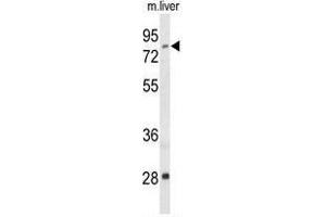Western blot analysis of ACSS2 Antibody (N-term) in mouse liver tissue lysates (35 µg/lane).