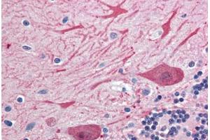 Human Brain, Cerebellum (formalin-fixed, paraffin-embedded) stained with STX2 antibody ABIN364385 at 10 ug/ml followed by biotinylated goat anti-rabbit IgG secondary antibody ABIN481713, alkaline phosphatase-streptavidin and chromogen. (STX2 antibody  (AA 1-19))