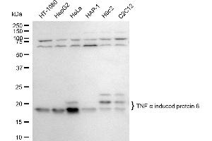 Western blotting analysis using TNF alpha induced protein 8 antibody (ABIN7800679).
