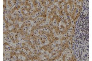 ABIN6273482 at 1/100 staining Human liver tissue by IHC-P. (MAP3K14 antibody  (C-Term))